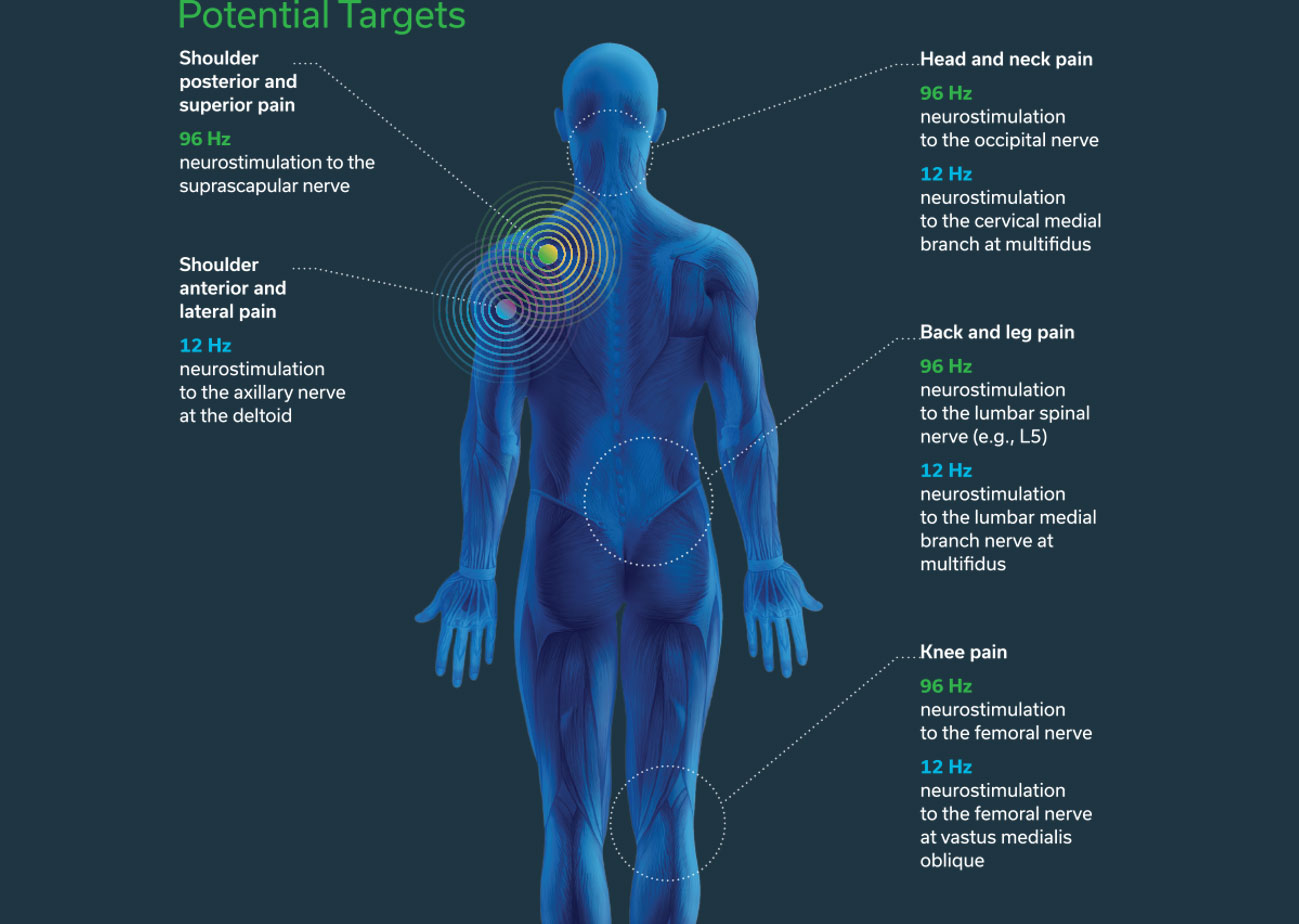 extensa potential targets